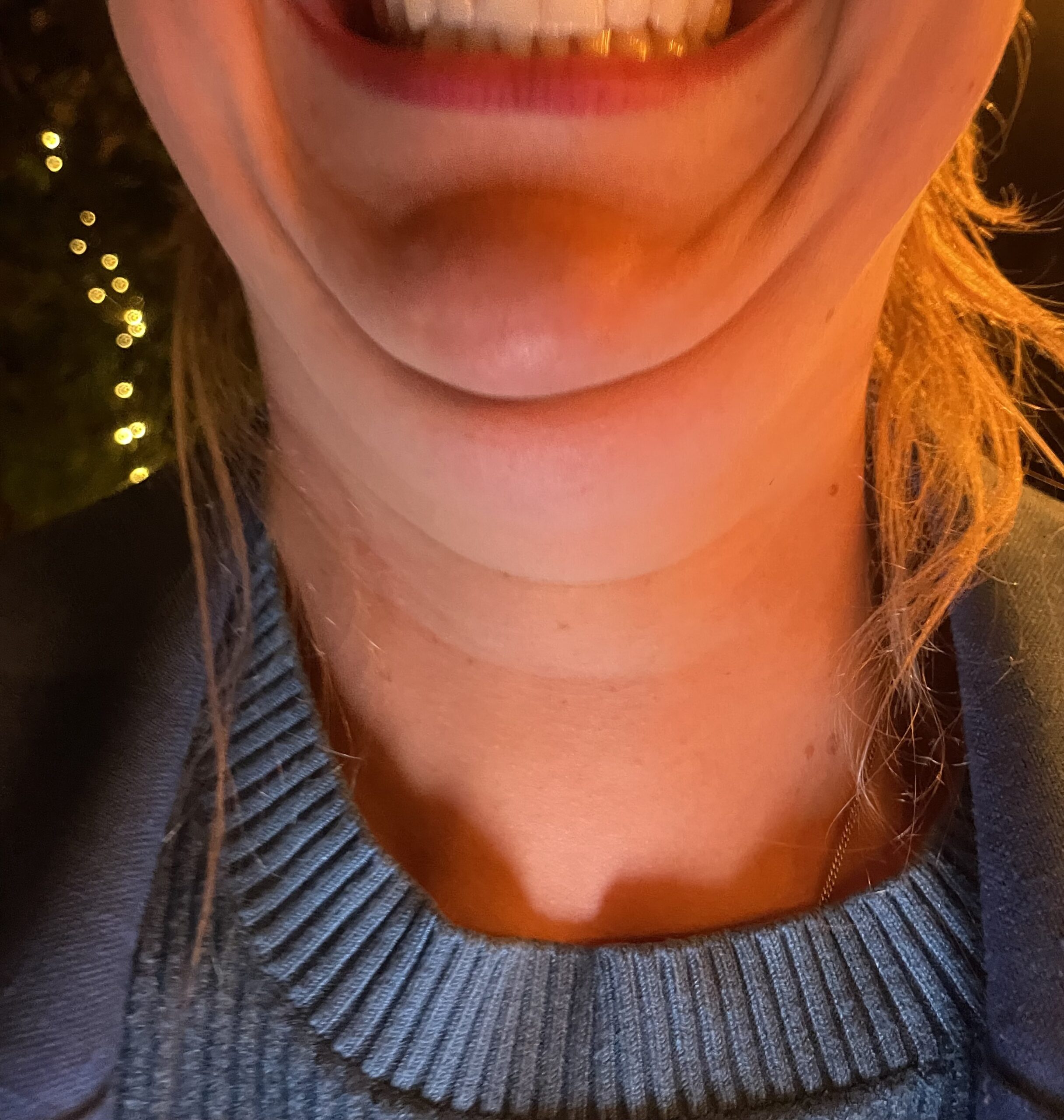 dikkekin